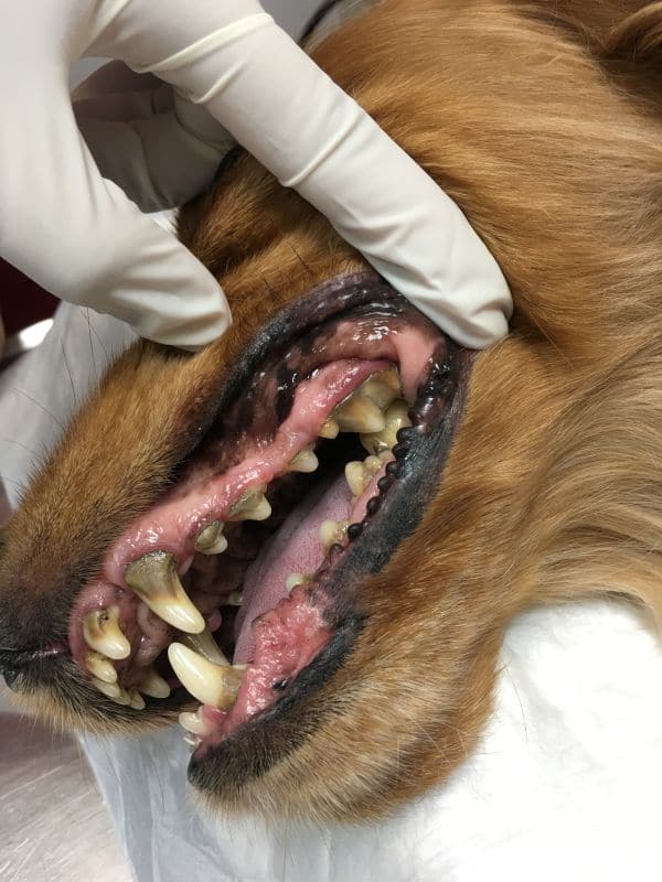 limpieza-de-boca-por-ultrasonidos